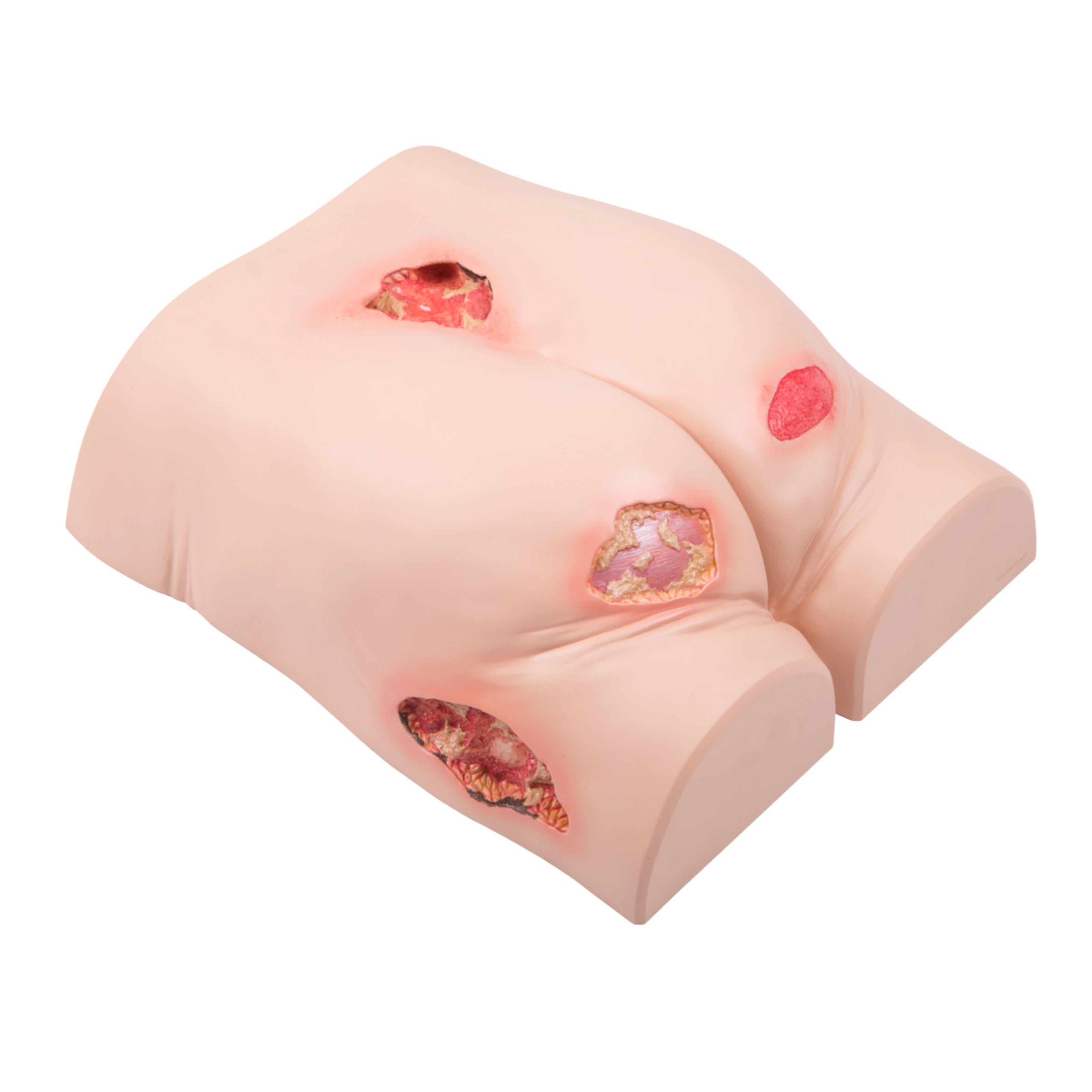 Entrenador de tratamiento de úlceras por presión