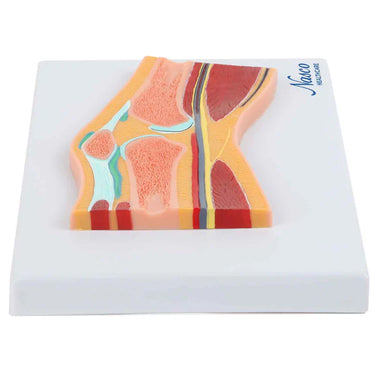 Modelo de Rodilla, Sección Mediana