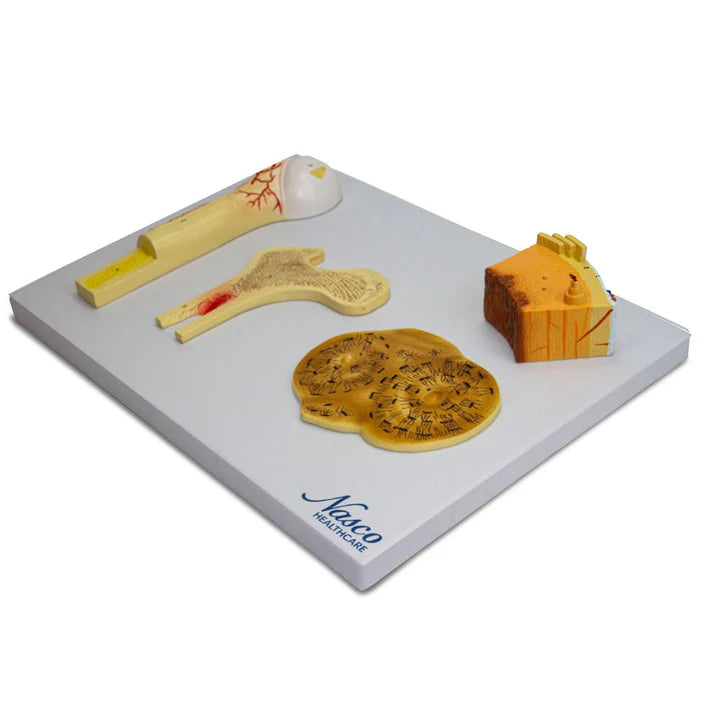 Modelo de Hueso, 4 Partes