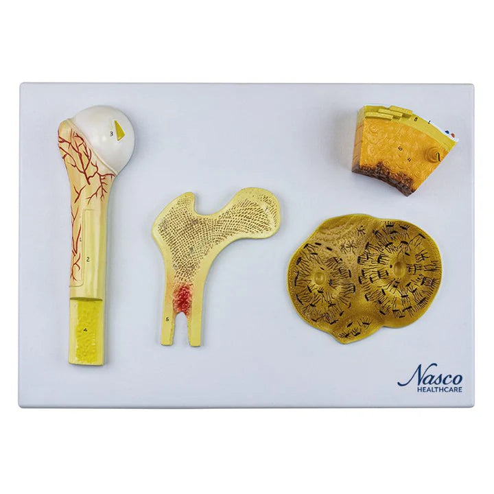 Modelo de Hueso, 4 Partes