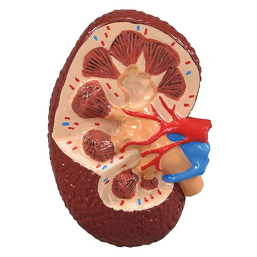 Modelo de Hipertensión Arterial