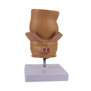 Modelo de Hemorroides, Ampliado 5X