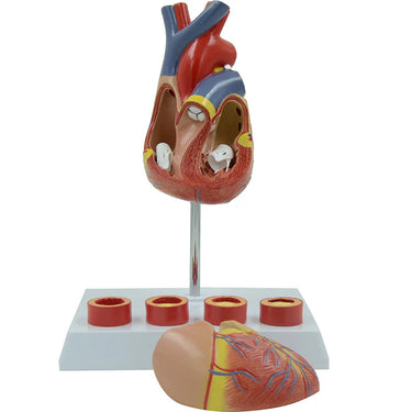 Modelo de Corazón con Arteriosclerosis