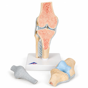Modelo de la articulación de la rodilla, dividido en 3 partes
