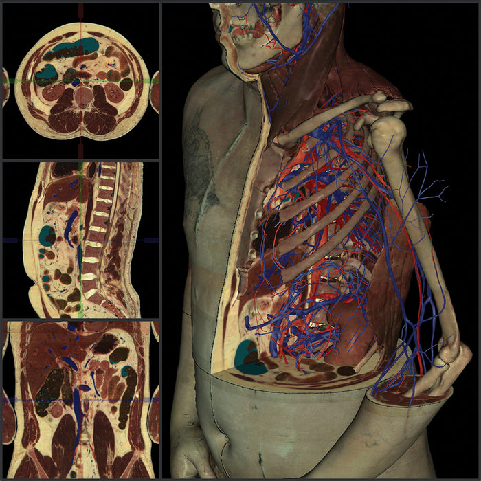 VH Dissector VR, AR y XR