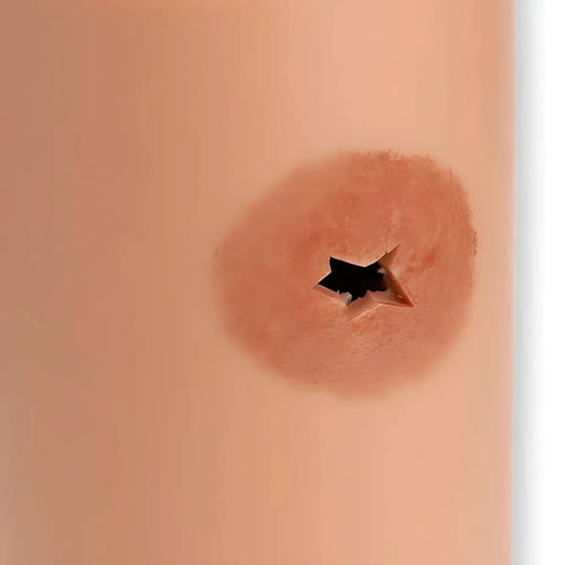 Simulador para Control de Hemorragias de Z-Medica