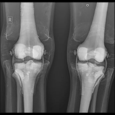 Maniquí de posicionamiento radiográfico de rayos X