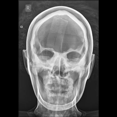 Maniquí de posicionamiento radiográfico de rayos X