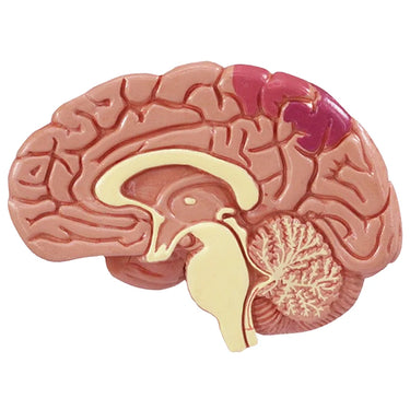 Modelo de Hipertensión Arterial