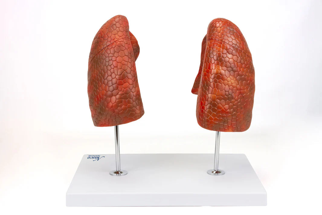 Modelo de Pulmón, 4 Partes