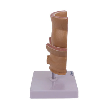 Modelo de Hemorroides, Ampliado 5X