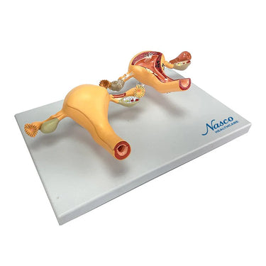 Modelo de Útero Saludable y Patológico