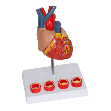 Modelo de Corazón con Arteriosclerosis