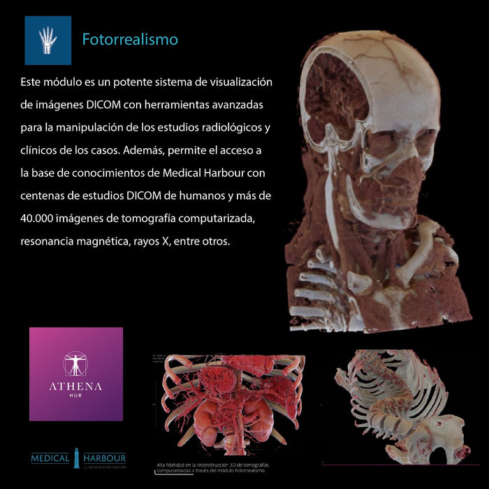 Mesa de Anatomía - Fotorrealismo